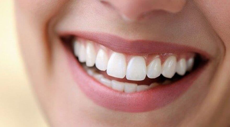diş beyazlatma yöntemleri